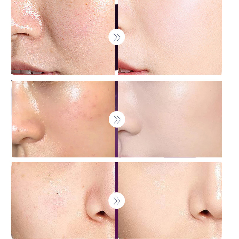 คอนซีลเลอร์บำรุงผิวหน้าครีมบำร - Luxury Skincare China บทวิจารณ์และราคา